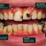 Saúde bucal: Por que consultar o dentista antes de sentir dor 4 ChatGPT Image 2 de out. de 2026 18 47 34
